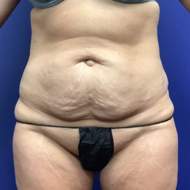 B&A