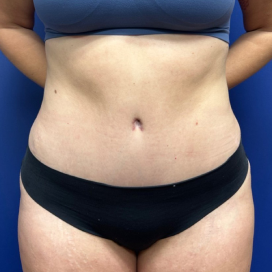 B&A